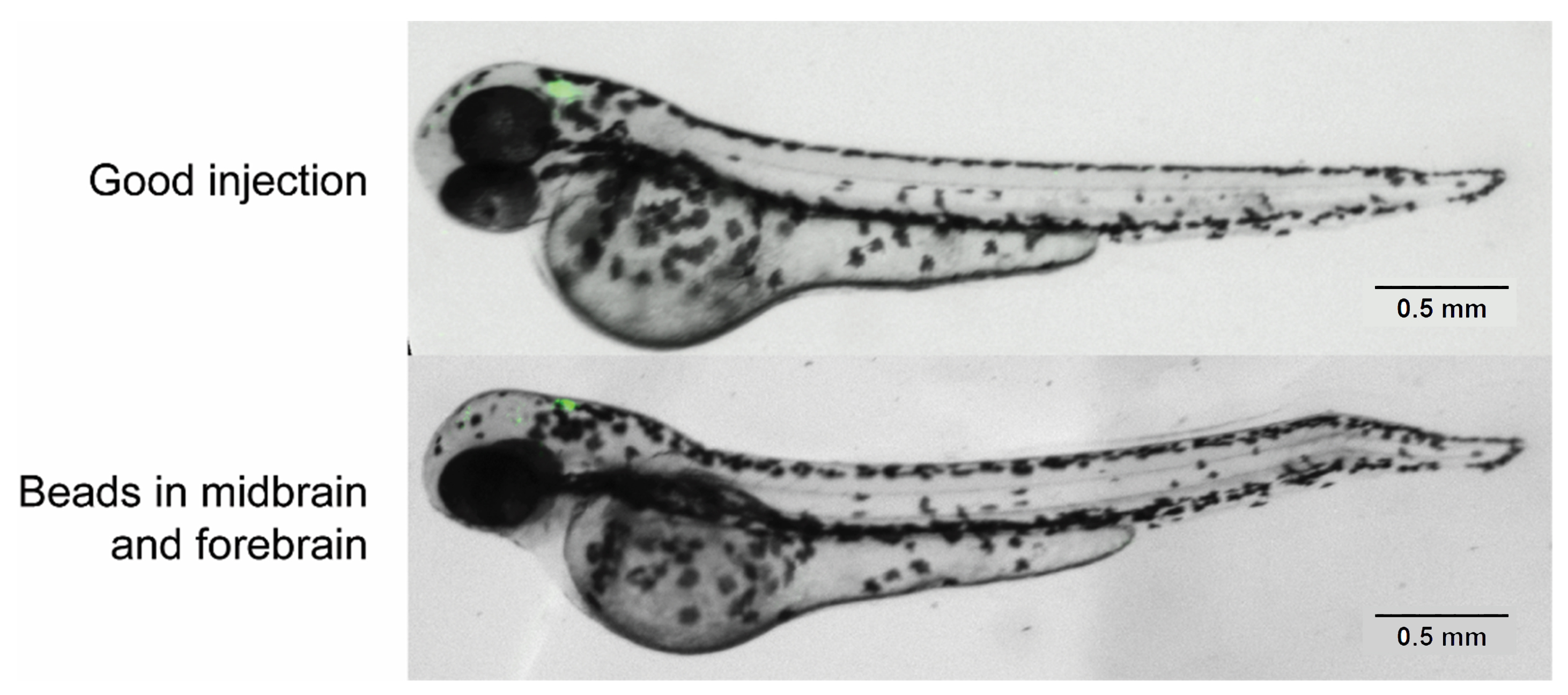 Automating Tumor Implantation in Zebrafish Larvae for Cancer Research ...