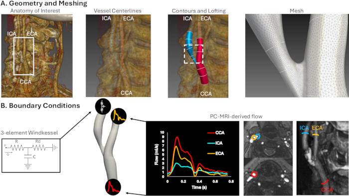 figure-results-1 "Cardiovascular MRI geometry, mesh, flow analysis; vessel contours, boundary conditions diagram."
