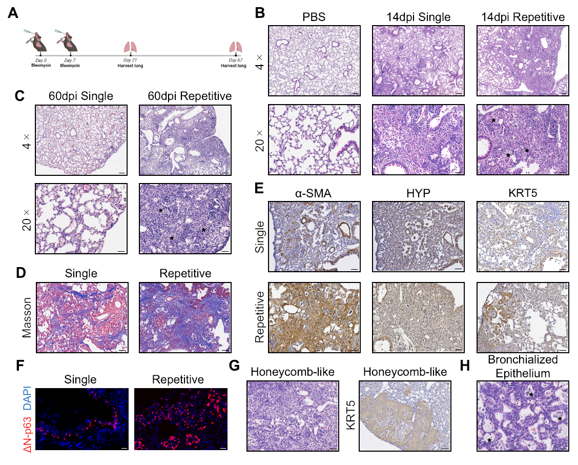 Refined Murine Model of Idiopathic Pulmonary Fibrosis