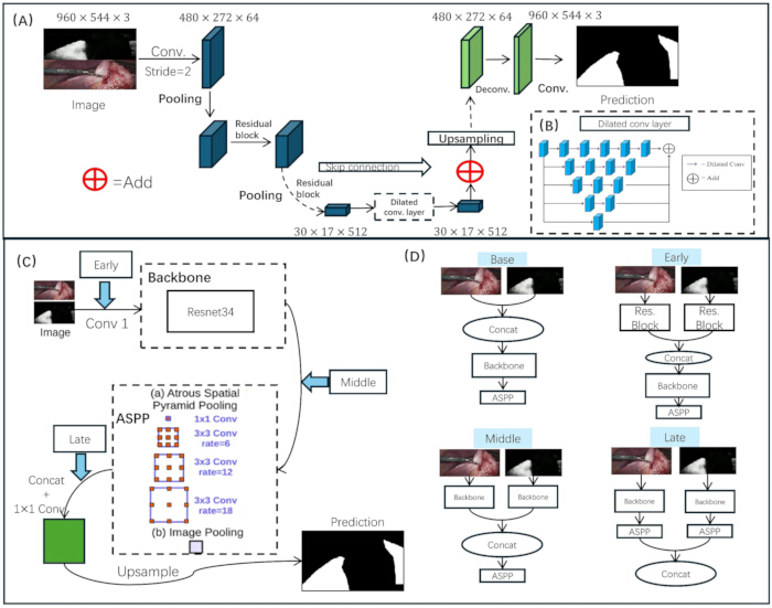 Deep learning segmentation diagram with ResNet34 backbone, pooling, upsampling, ASPP, and prediction.