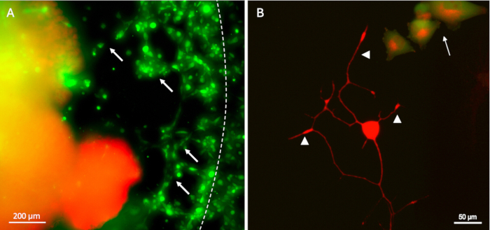 figure-results-11 Fluorescence microscopy images of neuronal cells, highlighting cell structures and synapses in red and green.