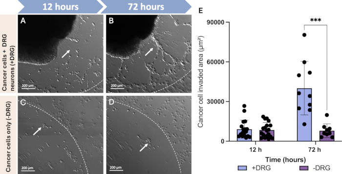 figure-results-12 Cancer cell invasion diagram; cell cultures over time with graph comparing invasion area.