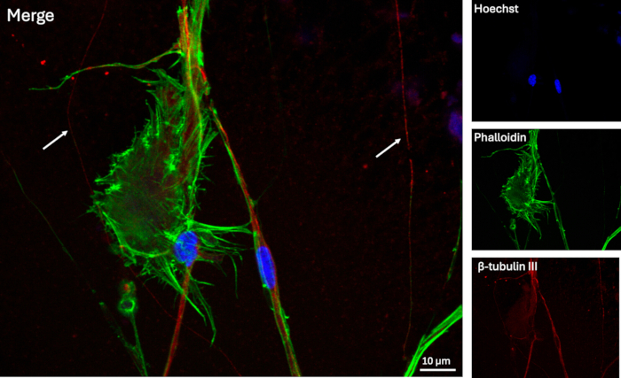 figure-results-14 Immunofluorescence microscopy with β-tubulin III, phalloidin, Hoechst; cell structure analysis.