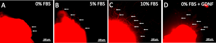 figure-results-7 Cellular growth under varying FBS conditions; fluorescence microscope image; neurite outgrowth analysis.