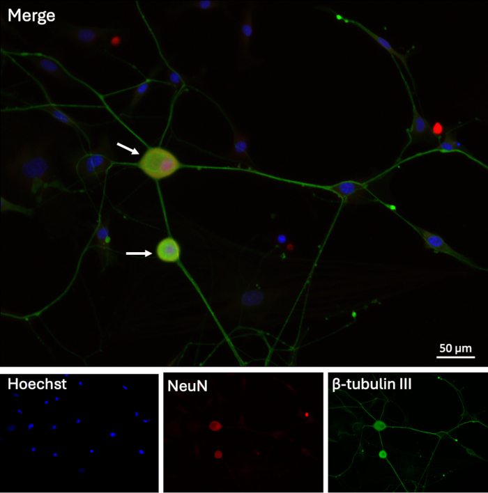 figure-results-9 Neuronal cells in immunofluorescence microscopy; Hoechst, NeuN, β-tubulin III markers; 50 µm scale.
