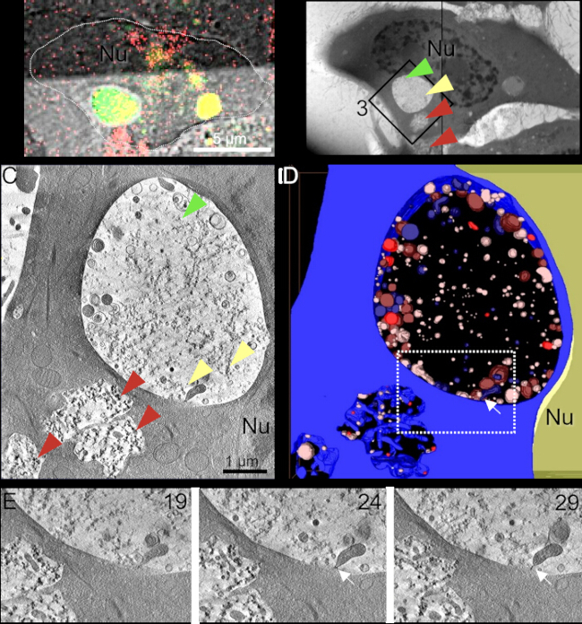 figure-results-2 Cellular ultrastructure analysis, electron microscopy images and segmentation results, highlighting nucleolus.