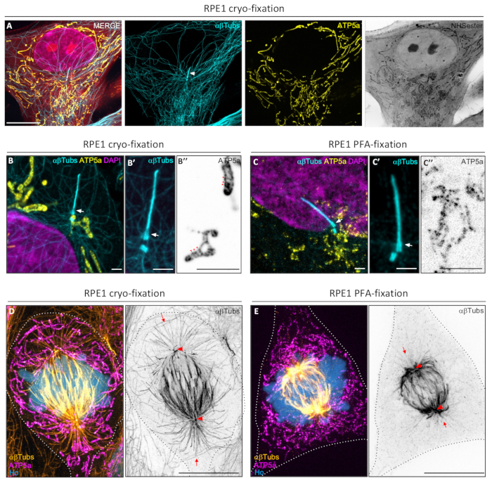 figure-results-3 RPE1 cryo-fixation microscopy: αβTubs, ATP5a, DAPI staining; cytoskeleton, mitochondria analysis.