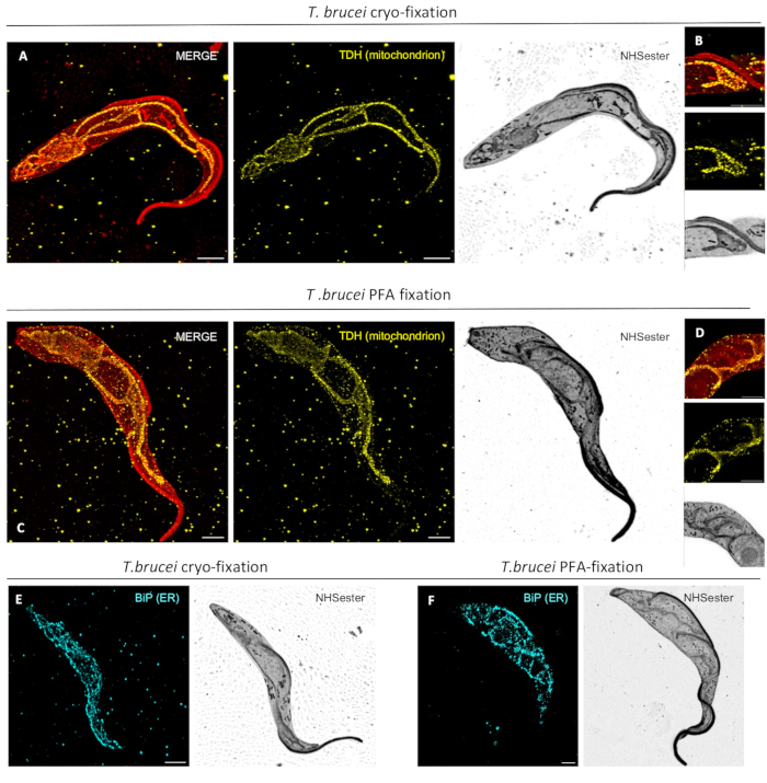 figure-results-4 T. brucei mitochondrion, ER localization; cryo vs. PFA fixation; fluorescence microscopy diagram.