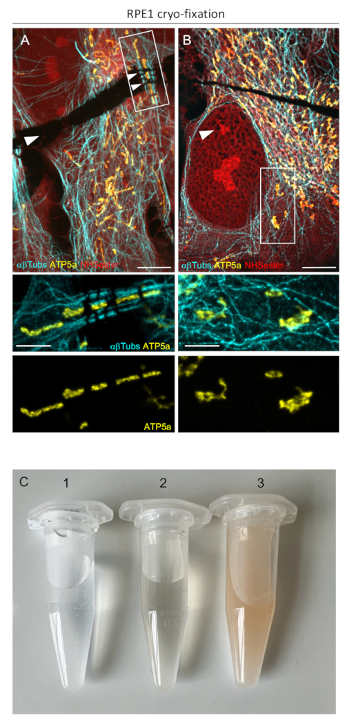 figure-results-5 Cryo-fixation microscopy of RPE1 cells highlighting αβTubulin and ATP5a, protein localization study.