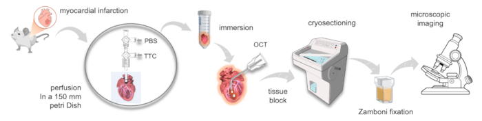 figure-results-1 Myocardial infarction process; diagram; PBS-TTC perfusion, cryosectioning, microscopic imaging.