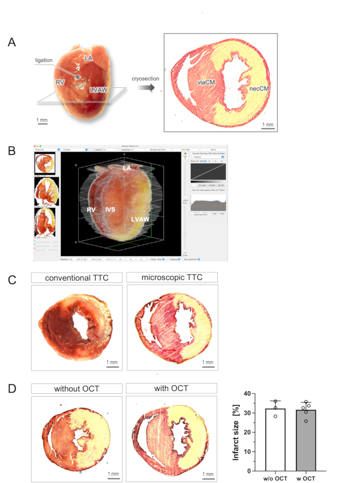 figure-results-2 Cardiac tissue analysis; cryosection diagram, TTC staining; infarct size comparison with/without OCT.
