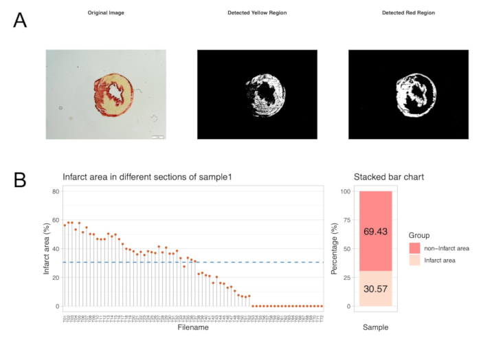 figure-results-4 Histological analysis; Infarct detection via image processing; Graph showing infarct area percentages.