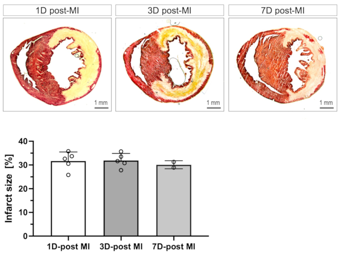 figure-results-5 Myocardial infarction histology slices with infarct size graph, 1D, 3D, 7D post-MI comparison.