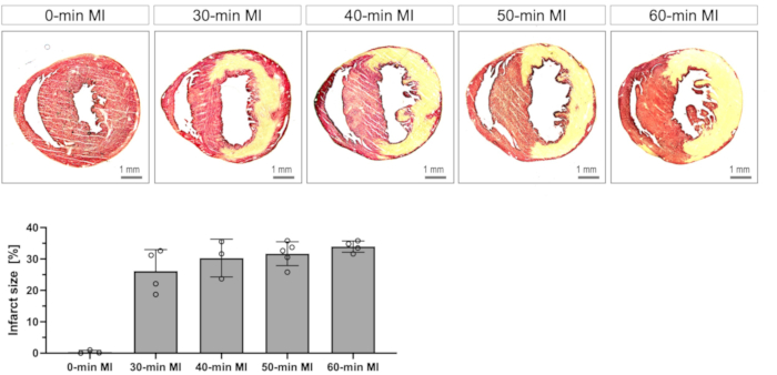 figure-results-6 Heart tissue staining over time showing infarction development, with bar graph of infarct size analysis.