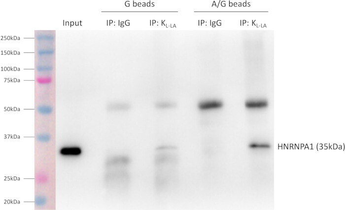 Western blot protein analysis, experiment, HNRNPA1 detection, immunoprecipitation, molecular weight.