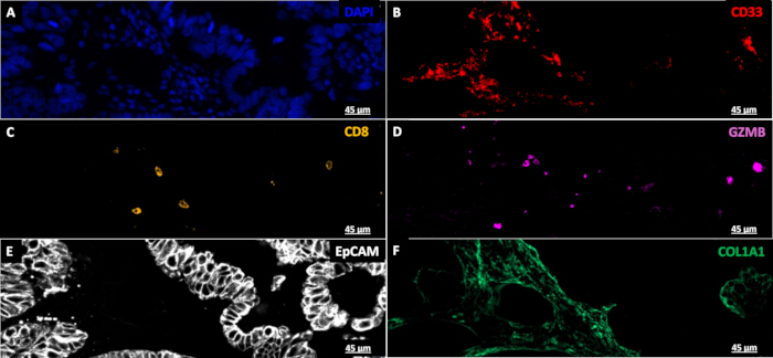 RNA In situ Hybridization with Sequential Protein Immunofluorescence in ...