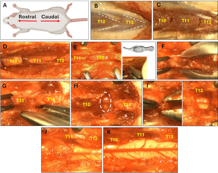 Rodent spinal surgery, T10-T13 vertebrae exposure diagram and procedural images; vertebral dissection.