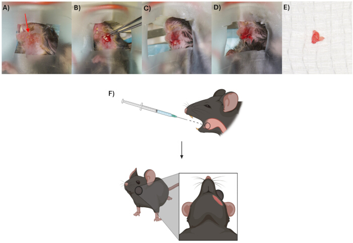 figure-protocol-2 Surgical procedure on mouse tumor, experimental setup for tumor injection diagram.