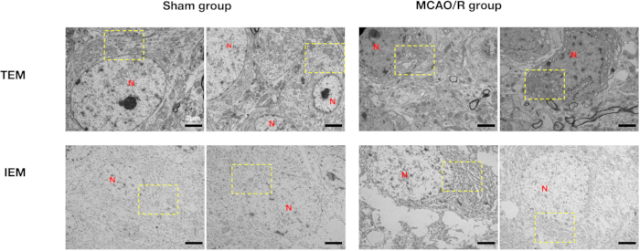 figure-results-3 TEM and IEM micrographs; neuronal tissue comparison, sham vs MCAO/R group; cell structure analysis.