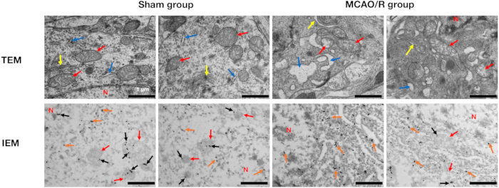 figure-results-4 Histology comparison: TEM and IEM micrographs of Sham and MCAO/R groups for cellular analysis.