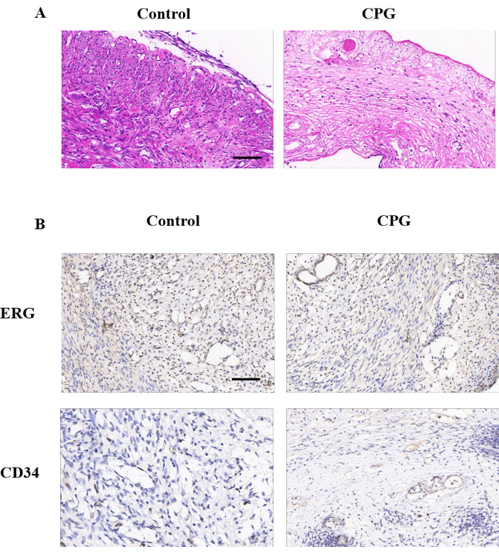 Histology comparison, Control vs. CPG, HE stain, ERG and CD34 markers, tissue structure analysis.