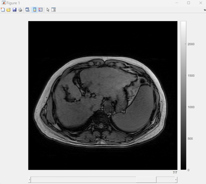 MRI abdominal cross-section, grayscale, diagnostic imaging, anatomical analysis.