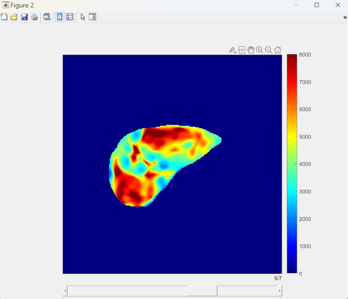 Thermal map diagram of liver tissue using spectroscopy; color scale indicates heat intensity.