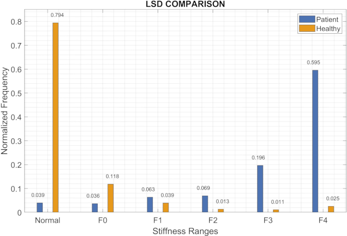 Liver stiffness distribution comparison chart; patient vs. healthy normalized frequency analysis.
