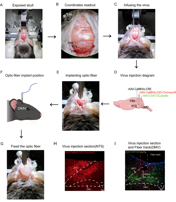 Optogenetic virus injection and optic-fiber implant in rodent; NTS, DMV targeting diagram.