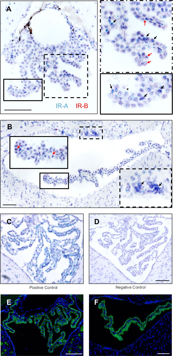 Precise Visualization of Insulin Receptors A and B in Murine Brain with ...
