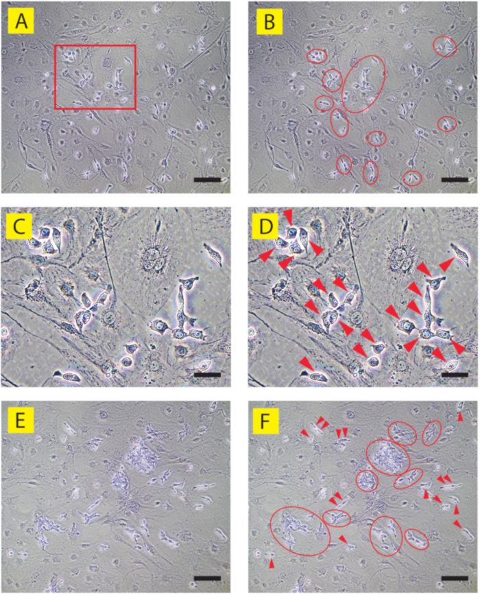 Cell migration analysis, microscopy image, highlighting cell movement patterns with annotations.