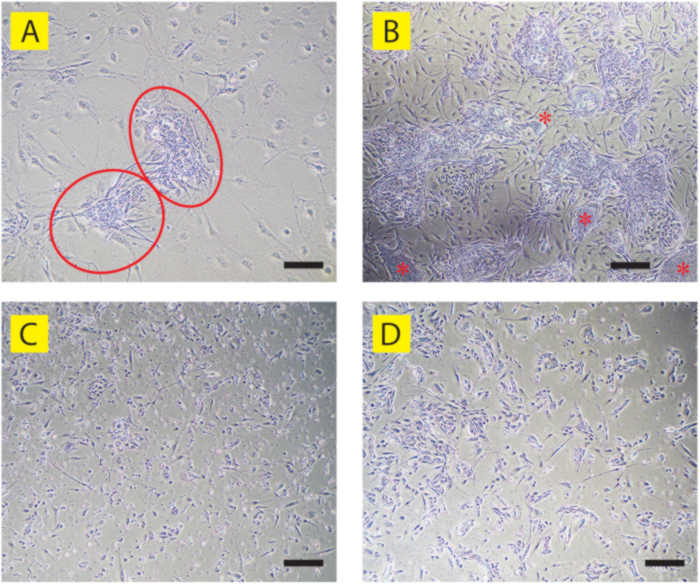 Cellular growth stages in four microscopic images; highlights cell clusters and confluence patterns.