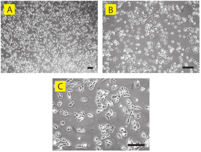 Cell density comparison, microscope images A-C, showing varying cell confluency and morphology changes.