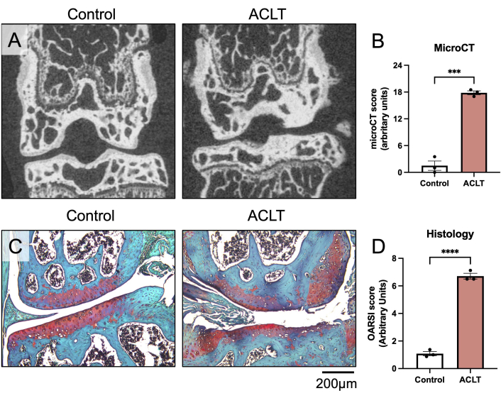 MicroCT and histology analysis diagram; ACLT vs Control; bone structure and scoring results comparison.