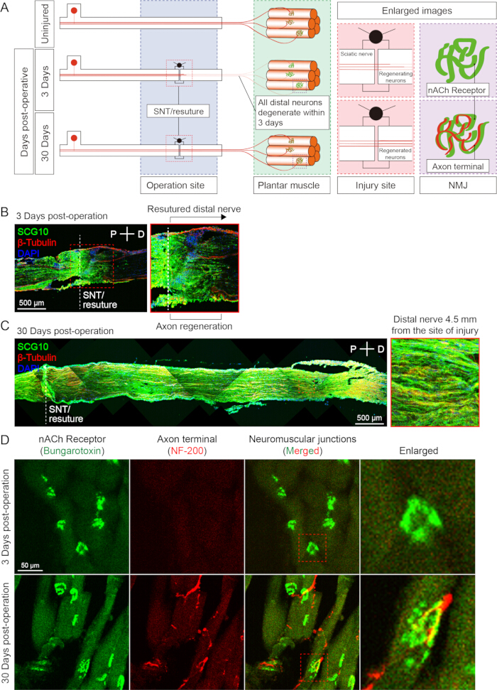 Nerve injury and regeneration diagram; α-Tubulin, SCG10 staining; axon regeneration observation.