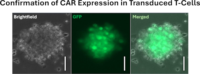 CAR expression in transduced T-cells; brightfield, GFP, merged microscope images for cell analysis.