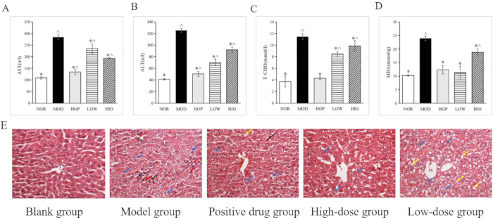 figure-results-6 Bar charts and histology images; liver function test results; treatment comparison groups.