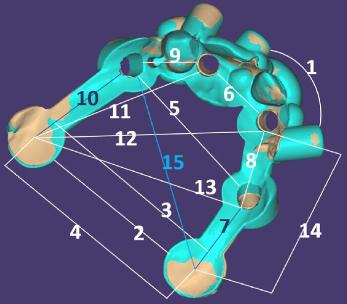 figure-results-8 3D dental implant bridge, topology diagram, numbers on surface structure, implant positioning analysis.
