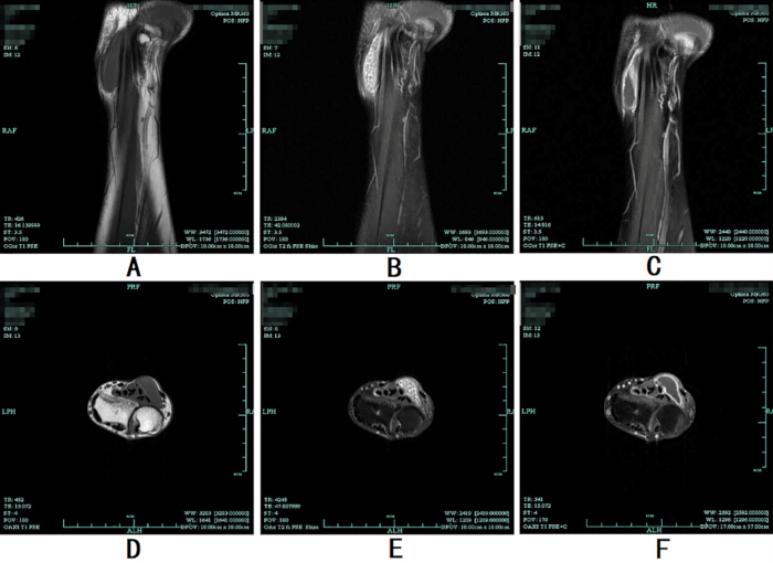 figure-results-1 MRI scan series of a shoulder and knee; medical imaging for joint and tissue assessment.