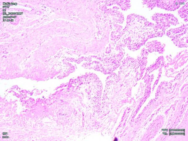 figure-results-10 Histology: Pink-stained tissue section under microscope showing cellular structure and morphology.