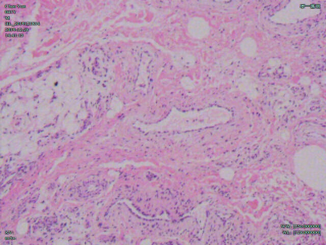 figure-results-12 Histology tissue section, microscope image, cellular structure, biological study, pathology analysis.
