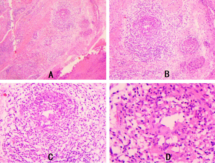 figure-results-3 Histopathology microscopy showing tissue inflammation, labeled A-D, highlighting cellular changes.
