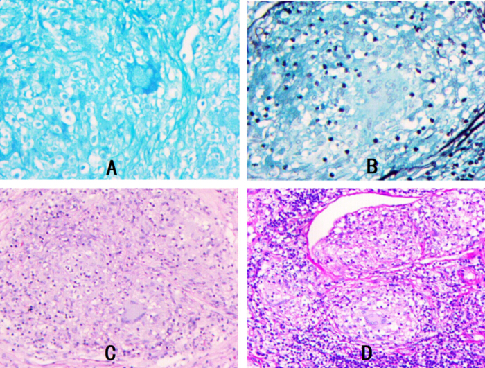 figure-results-4 Histological staining comparison; diagram of tissue samples A-D under microscope showing color variations.