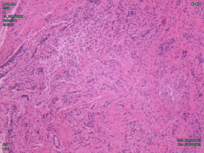 figure-results-8 Histological tissue section under microscope, showing cellular structure and staining pattern.