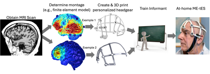 MRI scan to custom headgear process, using finite element models, 3D printing, and ME-tES setup.