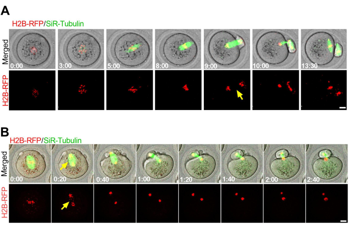 Cell division stages; time-lapse microscopy; H2B-RFP/SiR-Tubulin visualization; fluorescent markers.