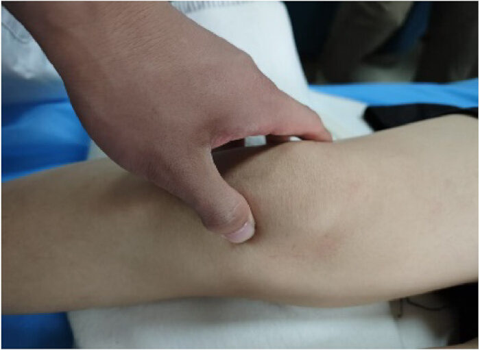 figure-results-3 Palpation method on arm, tactile examination, medical diagnostic technique for muscle assessment.