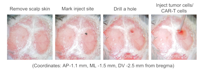 figure-results-1 Stereotaxic injection procedure diagram for CAR-T cells delivery in brain cancer research.