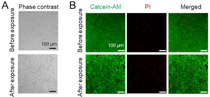 荧光显微镜，细胞活力检测，Calcein-AM，PI染色，暴露比较，100 µm。