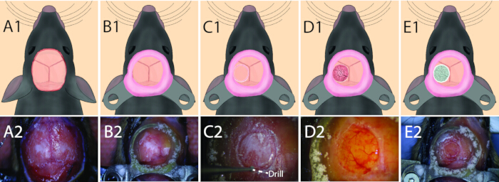 figure-protocol-1 Craniotomy process diagram and photos, surgical procedure stages, drill tool, experimental setup.
